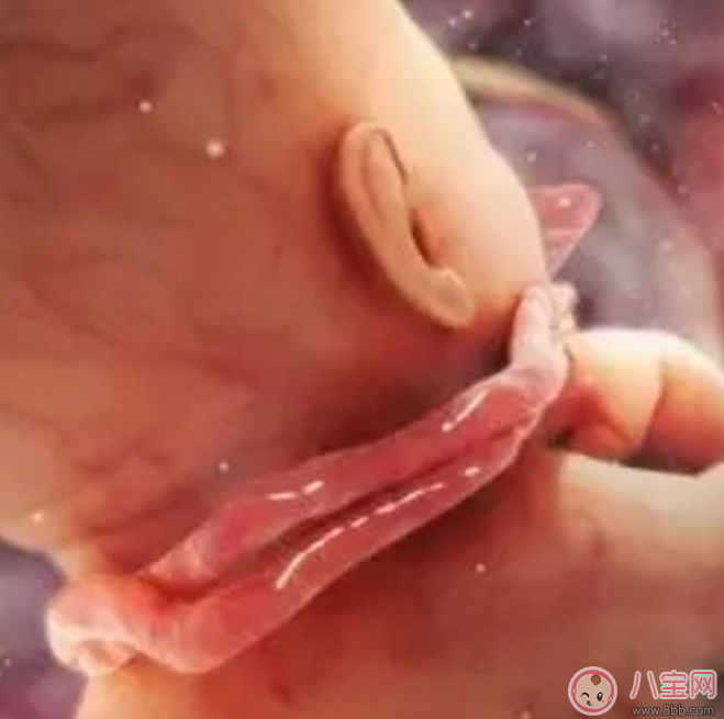 胎兒臍帶繞頸怎么辦？產前怎樣化解臍帶繞頸？
