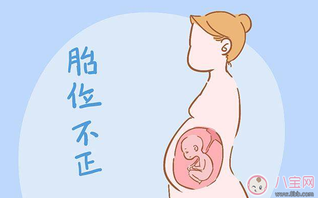 分娩是選順產還是剖腹產 醫生往往會參考這些數據
