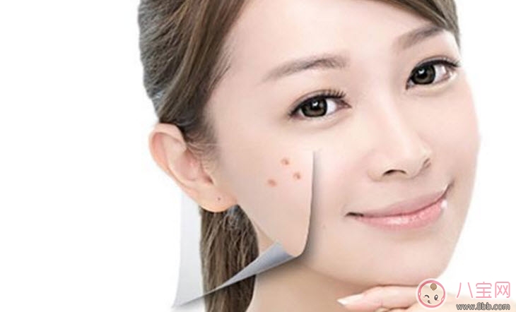 孕婦孕期長痘痘怎么辦 孕期痘痘怎么調理(長痘痘吃什么)