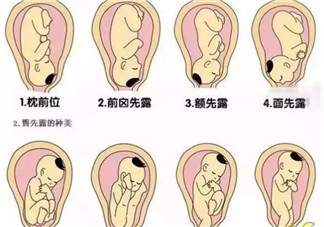 孕晚期胎位不正怎么辦 孕晚期胎位圖