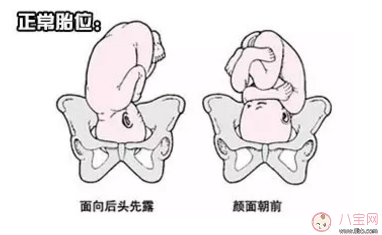孕期胎位不正的原因 如何矯正胎位不正