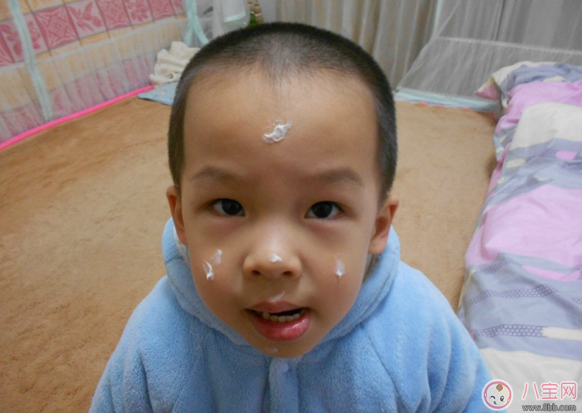 孩子皮膚變差怎么辦 秋季孩子護膚方法