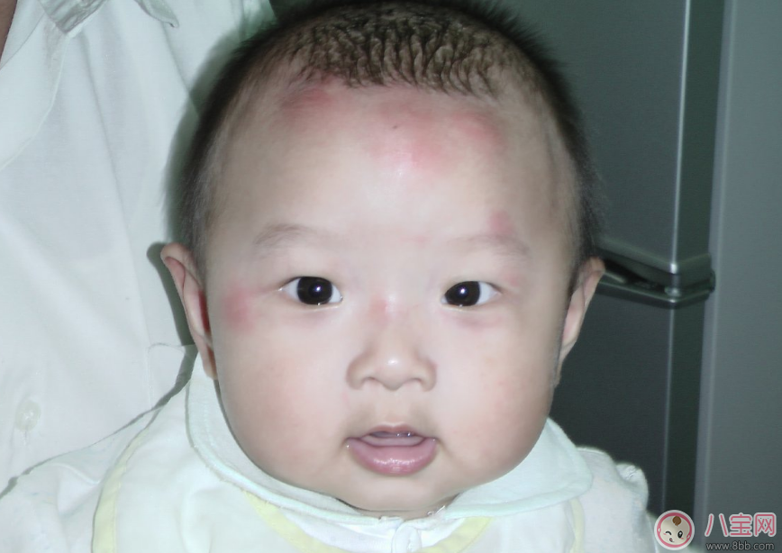 孩子皮膚變差怎么辦 秋季孩子護膚方法