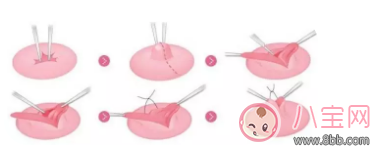 母乳喂養很艱難 別不小心走到坑里面去了