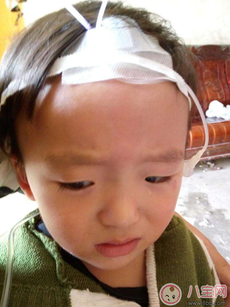 秋季腹瀉孩子狀態差 及時預防遠離它