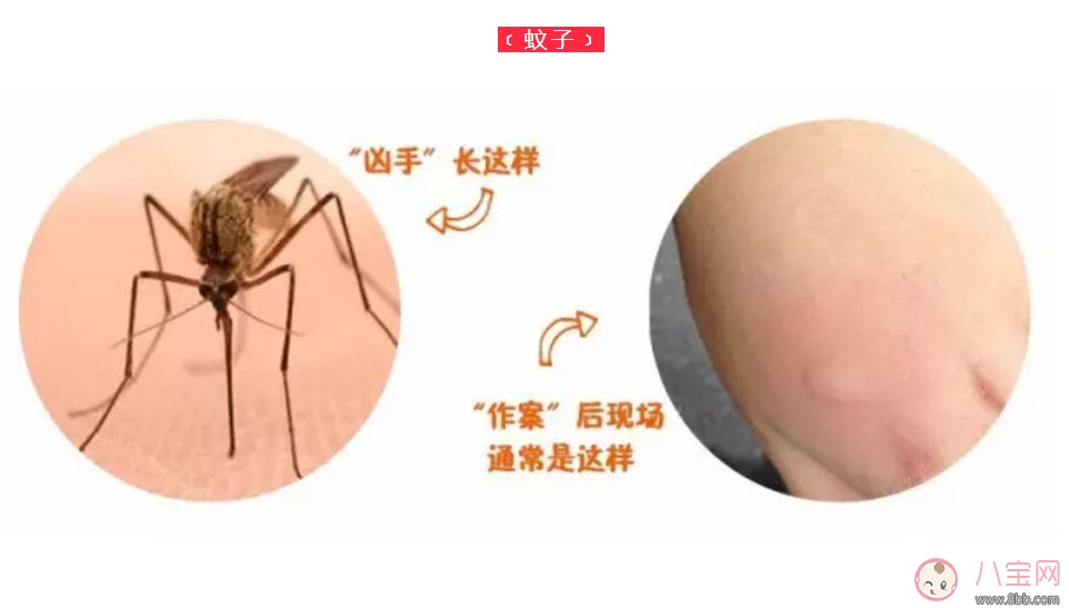 寶寶螨蟲過敏怎么辦，寶寶被螨蟲咬和蚊子咬癥狀對比圖片區別
