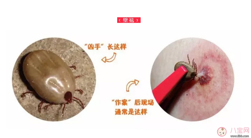 寶寶被蜱蟲咬了癥狀圖片 寶寶被蜱蟲咬和蚊子咬癥狀對比圖片區別