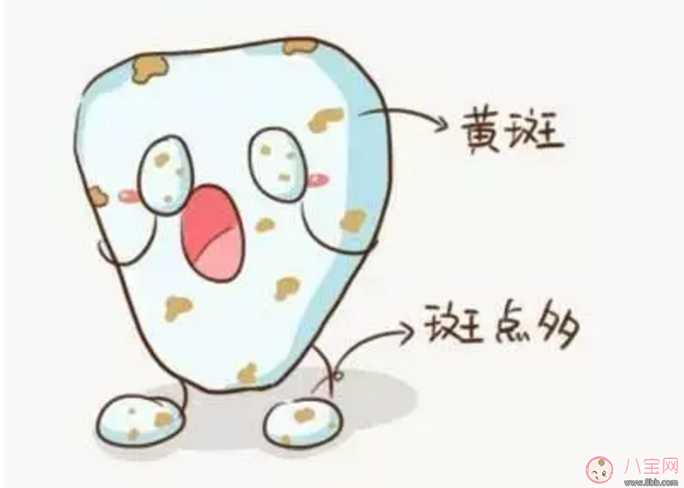寶寶沒有齲齒 卻有黑牙是怎么回事？