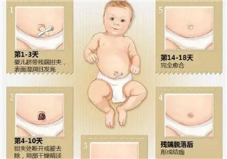 新生兒臍帶脫落的時間是幾天 新生兒臍帶脫落的過程圖解
