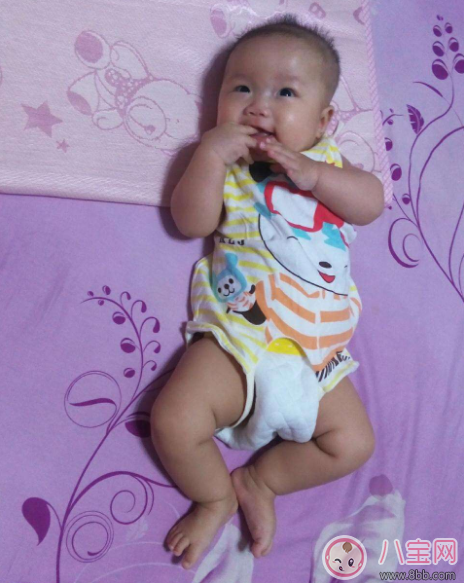 孩子總是長不胖是不是營養不良 寶寶怎么吃都瘦怎么辦