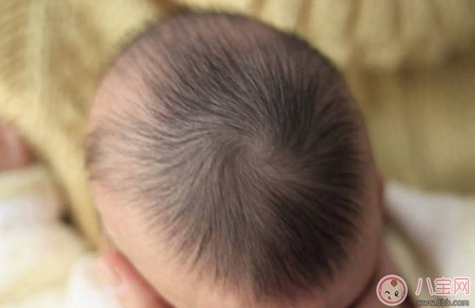 夏天寶寶出汗多是什么原因 寶寶出汗和虛汗的區別
