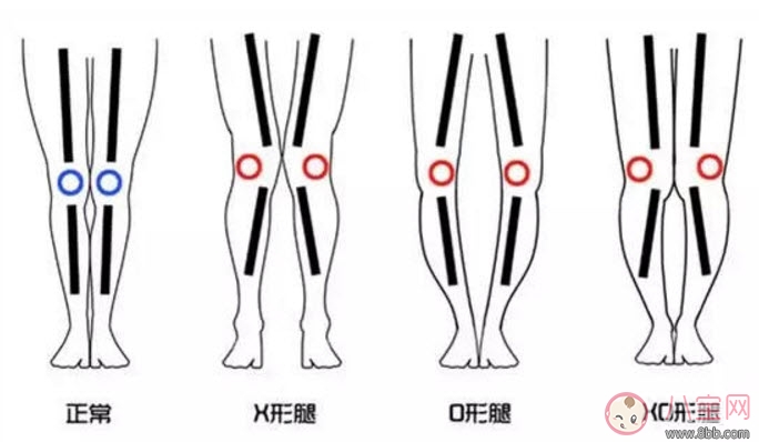 怎樣讓寶寶有大長腿 寶寶腿型注意事項
