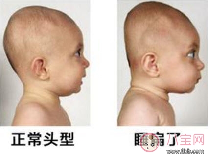 寶寶頭型睡偏了怎么辦 寶寶頭型調整怎么做