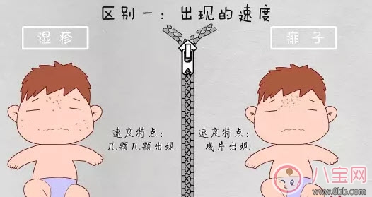 寶寶痱子和濕疹的區別 濕疹和痱子的區別圖片