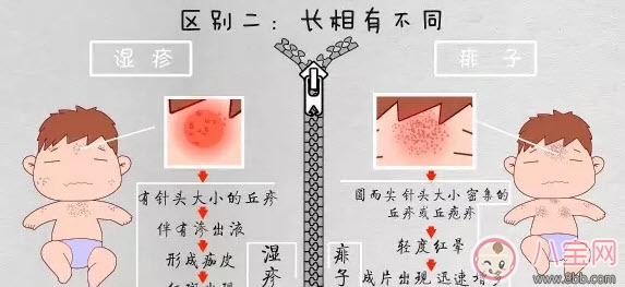 寶寶痱子和濕疹的區別 濕疹和痱子的區別圖片