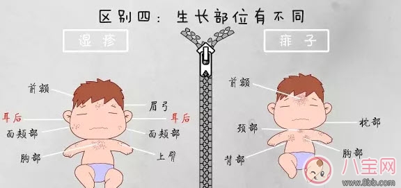 寶寶痱子和濕疹的區別 濕疹和痱子的區別圖片