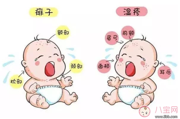 寶寶痱子和濕疹的區別 濕疹和痱子的區別圖片