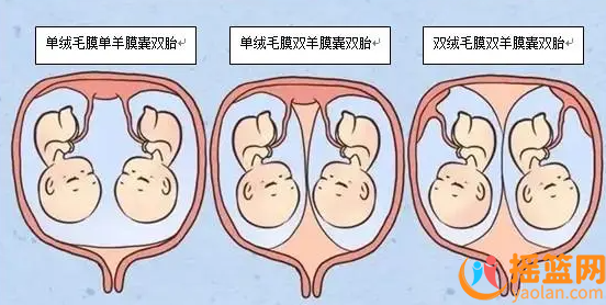 多胎妊娠現象