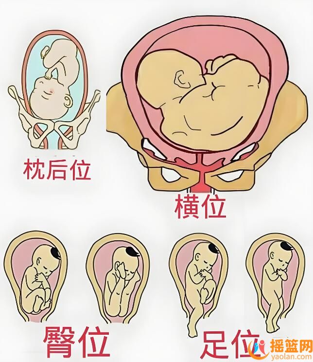 孕期胎位頻繁變化，如何應對？