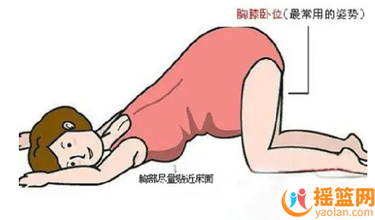 胎位不正：分娩前這樣糾正，避免難產風險