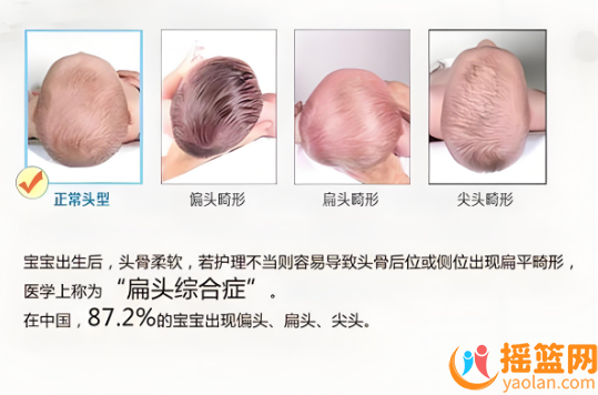 寶寶后腦勺扁平？如何將頭變圓呢？