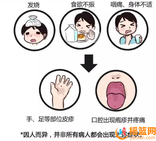 日本手足口病，5萬人感染！家庭安全必備知識