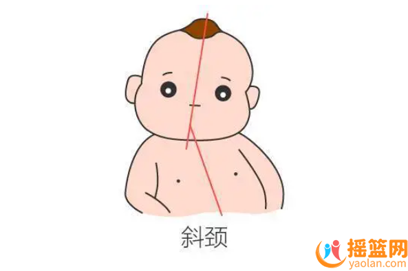 寶寶斜頸康復秘籍，睡姿調整一步到位！