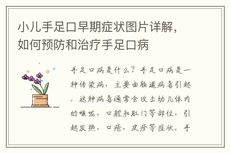 小兒手足口早期癥狀圖片詳解，如何預防和治療手足口病
