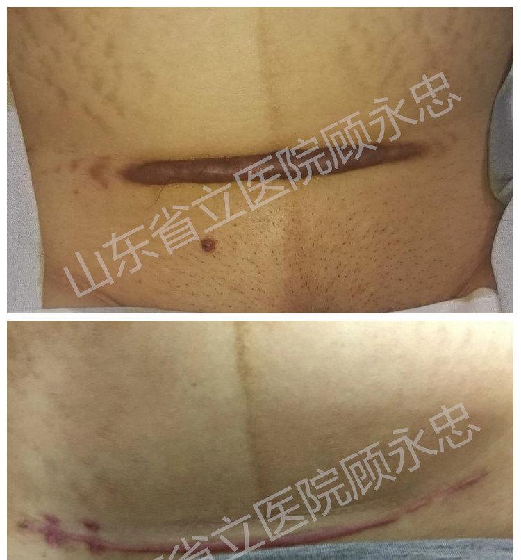 體重飲食記錄變化表孕前和孕后_孕前飲食記錄體重變化表_孕期體重記錄表