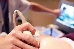 體檢清淡飲食孕前要檢查嗎_孕前體檢要清淡飲食_孕前體檢前能吃東西嗎