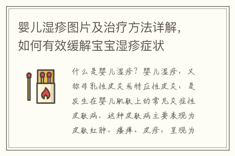 嬰兒濕疹圖片及治療方法詳解，如何有效緩解寶寶濕疹癥狀