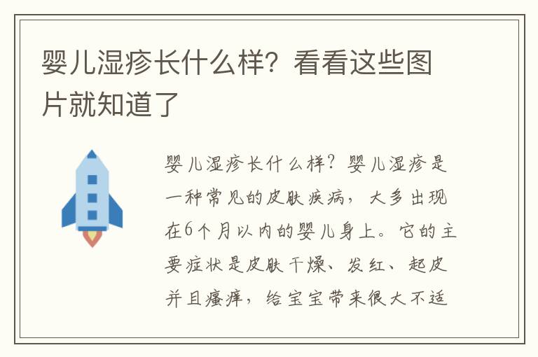 嬰兒濕疹長什么樣？看看這些圖片就知道了