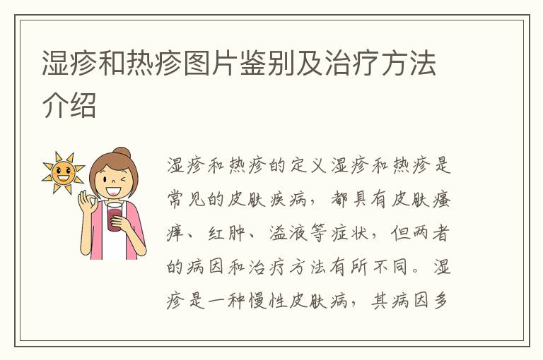 濕疹和熱疹圖片鑒別及治療方法介紹