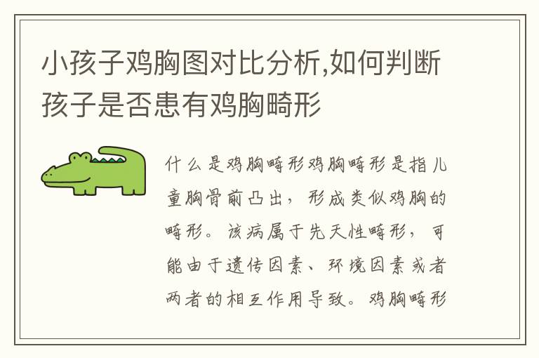 小孩子雞胸圖對比分析,如何判斷孩子是否患有雞胸畸形