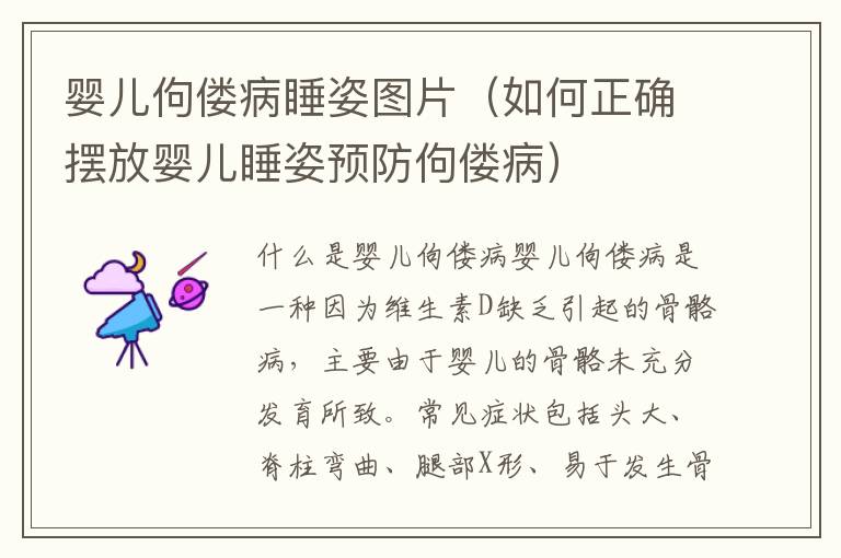嬰兒佝僂病睡姿圖片（如何正確擺放嬰兒睡姿預防佝僂?。?><p><strong>嬰兒佝僂病睡姿圖片（如何正確擺放嬰兒睡姿預防佝僂?。?/strong></p></a></li><li><a href=