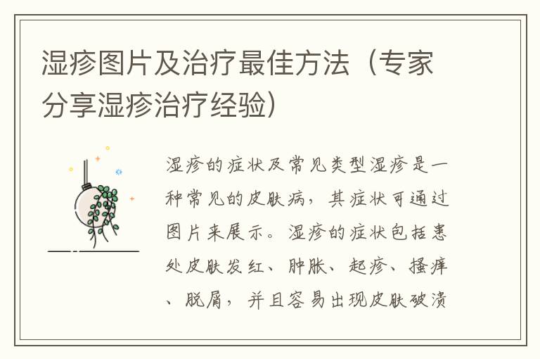 濕疹圖片及治療最佳方法（專家分享濕疹治療經驗）