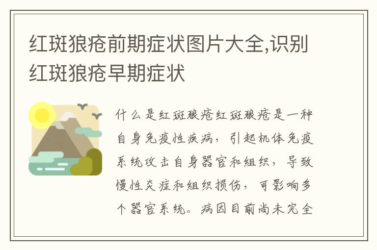 紅斑狼瘡前期癥狀圖片大全,識別紅斑狼瘡早期癥狀